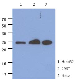 MRRF Antibody - Western Blot: The cell lysates (40 ug) were resolved by SDS-PAGE, transferred to PVDF membrane and probed with anti-human MRRF antibody (1:1000). Proteins were visualized using a goat anti-mouse secondary antibody conjugated to HRP and an ECL detection system.