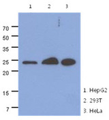 MRRF Antibody - Western Blot: The cell lysates (40 ug) were resolved by SDS-PAGE, transferred to PVDF membrane and probed with anti-human MRRF antibody (1:1000). Proteins were visualized using a goat anti-mouse secondary antibody conjugated to HRP and an ECL detection system.
