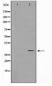 MRRF Antibody - Western blot of HeLa cell lysate using MRRF Antibody