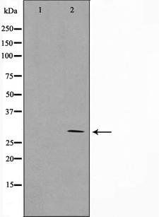 MRRF Antibody - Western blot analysis on HeLa cell lysates using MRRF antibody. The lane on the left is treated with the antigen-specific peptide.