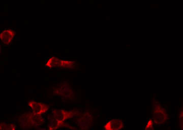 MRRF Antibody - Staining HeLa cells by IF/ICC. The samples were fixed with PFA and permeabilized in 0.1% Triton X-100, then blocked in 10% serum for 45 min at 25°C. The primary antibody was diluted at 1:200 and incubated with the sample for 1 hour at 37°C. An Alexa Fluor 594 conjugated goat anti-rabbit IgG (H+L) Ab, diluted at 1/600, was used as the secondary antibody.