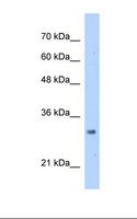 MRTO4 Antibody - Jurkat cell lysate. Antibody concentration: 2.5 ug/ml. Gel concentration: 12%.  This image was taken for the unconjugated form of this product. Other forms have not been tested.