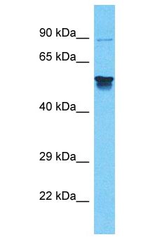 MRVI1 Antibody - MRVI1 antibody Western Blot of Thymus Tumor. Antibody dilution: 1 ug/ml.  This image was taken for the unconjugated form of this product. Other forms have not been tested.