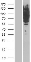 MRVI1 Protein - Western validation with an anti-DDK antibody * L: Control HEK293 lysate R: Over-expression lysate