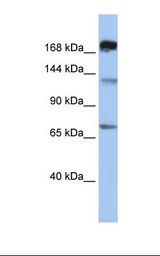 MS / MTR Antibody - 721_B cell lysate. Antibody concentration: 1.0 ug/ml. Gel concentration: 6-18%.  This image was taken for the unconjugated form of this product. Other forms have not been tested.