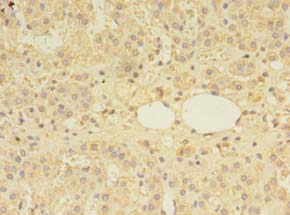 MS / MTR Antibody - Immunohistochemistry of paraffin-embedded human adrenal gland tissue using antibody at 1:100 dilution.