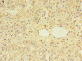 MS / MTR Antibody - Immunohistochemistry of paraffin-embedded human adrenal gland tissue using MTR Antibody at dilution of 1:100