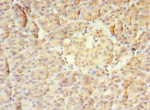 MS / MTR Antibody - Immunohistochemistry of paraffin-embedded human pancreatic tissue using MTR Antibody at dilution of 1:100