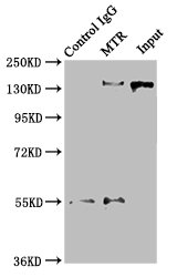 MS / MTR Antibody - Immunoprecipitating MTR in Hela whole cell lysate Lane 1: Rabbit control IgG instead of MTR Antibody in Hela whole cell lysate.For western blotting, a HRP-conjugated Protein G antibody was used as the secondary antibody (1/2000) Lane 2: MTR Antibody (8µg) + Hela whole cell lysate (500µg) Lane 3: Hela whole cell lysate (10µg)