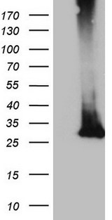MS4A12 Antibody - HEK293T cells were transfected with the pCMV6-ENTRY control. (Left lane) or pCMV6-ENTRY. (Right lane) cDNA for 48 hrs and lysed