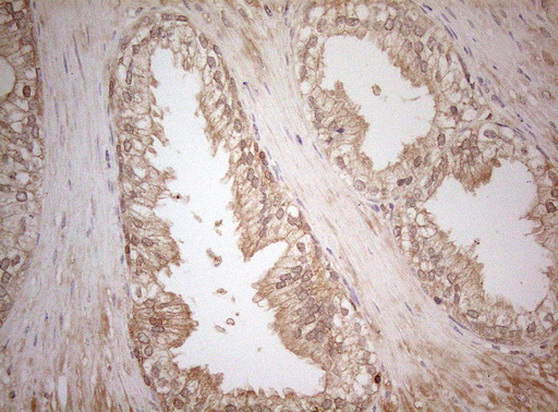 MS4A12 Antibody - Immunohistochemical staining of paraffin-embedded Human prostate tissue within the normal limits using anti-MS4A12 mouse monoclonal antibody. (Heat-induced epitope retrieval by 1mM EDTA in 10mM Tris buffer. (pH8.5) at 120°C for 3 min. (1:150)
