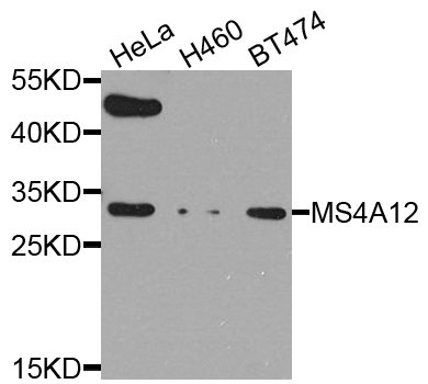 MS4A12 Antibody - Western blot analysis of extract of various cells.