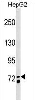 MS4A14 / MS4A13 Antibody - MS4A14 Antibody western blot of HepG2 cell line lysates (35 ug/lane). The MS4A14 antibody detected the MS4A14 protein (arrow).