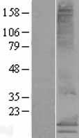 MS4A15 Protein - Western validation with an anti-DDK antibody * L: Control HEK293 lysate R: Over-expression lysate