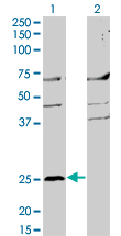 MS4A2 / FCERI Antibody - Western Blot analysis of MS4A2 expression in transfected 293T cell line by MS4A2 monoclonal antibody (M02), clone 3B1.Lane 1: MS4A2 transfected lysate(26.5 KDa).Lane 2: Non-transfected lysate.