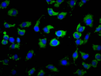 MS4A2 / FCERI Antibody - Immunofluorescence staining of A549 cells diluted at 1:133, counter-stained with DAPI. The cells were fixed in 4% formaldehyde, permeabilized using 0.2% Triton X-100 and blocked in 10% normal Goat Serum. The cells were then incubated with the antibody overnight at 4°C.The Secondary antibody was Alexa Fluor 488-congugated AffiniPure Goat Anti-Rabbit IgG (H+L).