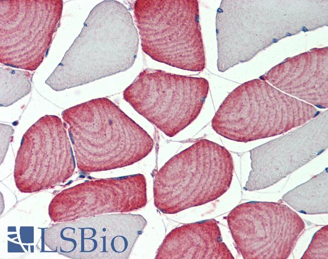 MS4A3 Antibody - Human, Skeletal muscle: Formalin-Fixed Paraffin-Embedded (FFPE).  This image was taken for the unconjugated form of this product. Other forms have not been tested.