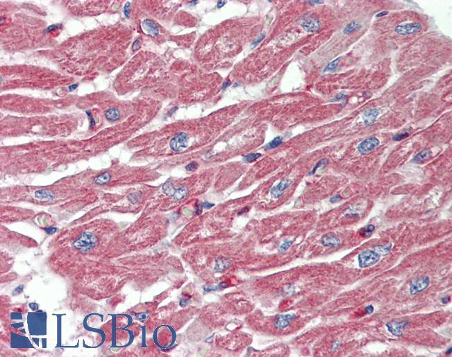 MS4A3 Antibody - Human, Heart: Formalin-Fixed Paraffin-Embedded (FFPE).  This image was taken for the unconjugated form of this product. Other forms have not been tested.