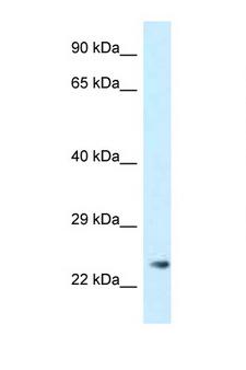 MS4A3 Antibody - MS4A3 antibody Western blot of 721_B Cell lysate. Antibody concentration 1 ug/ml.  This image was taken for the unconjugated form of this product. Other forms have not been tested.