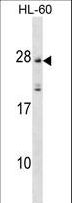 MS4A5 Antibody - MS4A5 Antibody western blot of HL-60 cell line lysates (35 ug/lane). The MS4A5 antibody detected the MS4A5 protein (arrow).