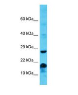 MS4A6E Antibody - Western blot of MS4A6E Antibody - middle region with human Jurkat cells lysate.  This image was taken for the unconjugated form of this product. Other forms have not been tested.