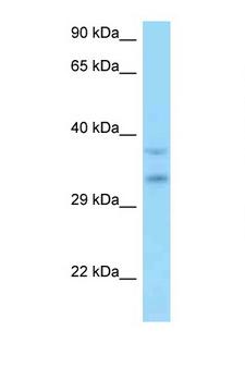 MSANTD3 Antibody - C9orf30 antibody Western blot of HT1080 Cell lysate. Antibody concentration 1 ug/ml.  This image was taken for the unconjugated form of this product. Other forms have not been tested.