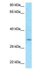 MSANTD3 Antibody - MSANTD3 antibody Western Blot of HepG2.  This image was taken for the unconjugated form of this product. Other forms have not been tested.