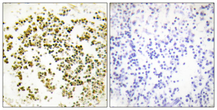 MSC / Musculin Antibody - Immunohistochemistry analysis of paraffin-embedded human lymph node tissue, using Musculin Antibody. The picture on the right is blocked with the synthesized peptide.