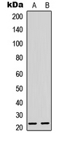 MSC / Musculin Antibody - Western blot analysis of Musculin expression in K562 (A); mouse brain (B) whole cell lysates.