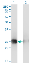 MSC / Musculin Antibody - Western blot of MSC expression in transfected 293T cell line by MSC monoclonal antibody (M05), clone 4D7.