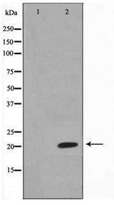 MSC / Musculin Antibody - Western blot of Jurkat cell lysate using Musculin Antibody