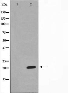 MSC / Musculin Antibody - Western blot analysis on Jurkat cell lysates using Musculin antibody. The lane on the left is treated with the antigen-specific peptide.