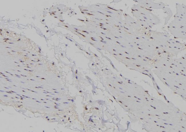 MSC / Musculin Antibody - 1:100 staining human gastric tissue by IHC-P. The sample was formaldehyde fixed and a heat mediated antigen retrieval step in citrate buffer was performed. The sample was then blocked and incubated with the antibody for 1.5 hours at 22°C. An HRP conjugated goat anti-rabbit antibody was used as the secondary.