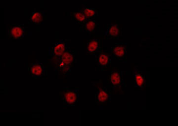 MSC / Musculin Antibody - Staining HeLa cells by IF/ICC. The samples were fixed with PFA and permeabilized in 0.1% Triton X-100, then blocked in 10% serum for 45 min at 25°C. The primary antibody was diluted at 1:200 and incubated with the sample for 1 hour at 37°C. An Alexa Fluor 594 conjugated goat anti-rabbit IgG (H+L) Ab, diluted at 1/600, was used as the secondary antibody.