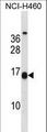 MSGN1 Antibody - MSGN1 Antibody western blot of NCI-H460 cell line lysates (35 ug/lane). The MSGN1 antibody detected the MSGN1 protein (arrow).