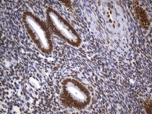 MSH2 Antibody - Immunohistochemical staining of paraffin-embedded Human endometrium tissue within the normal limits using anti-MSH2 mouse monoclonal antibody. (Heat-induced epitope retrieval by 1mM EDTA in 10mM Tris buffer. (pH8.0) at 120°C for 2.5 min. (1:2400)
