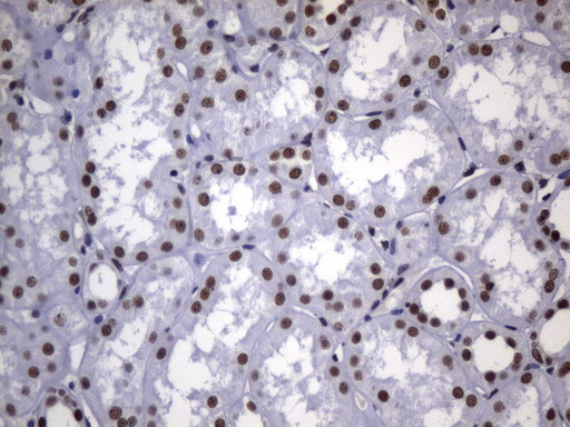 MSH2 Antibody - Immunohistochemical staining of paraffin-embedded Human Kidney tissue within the normal limits using anti-MSH2 mouse monoclonal antibody. (Heat-induced epitope retrieval by 1mM EDTA in 10mM Tris buffer. (pH8.0) at 120°C for 2.5 min. (1:2400)