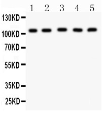 MSH2 Antibody - MSH2 antibody Western blot. All lanes: Anti MSH2 at 0.5 ug/ml. Lane 1: Mouse Testis Tissue Lysate at 50 ug. Lane 2: Mouse Skeletal Muscle Tissue Lysate at 50 ug. Lane 3: HELA Whole Cell Lysate at 40 ug. Lane 4: A549 Whole Cell Lysate at 40 ug. Lane 5: SMMC Whole Cell Lysate at 40 ug. Predicted band size: 105 kD. Observed band size: 105 kD.