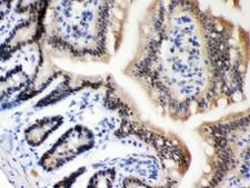 MSH2 Antibody - MSH2 antibody IHC-paraffin: Mouse Intestine Tissue.