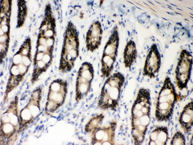 MSH2 Antibody - MSH2 antibody IHC-paraffin: Rat Intestine Tissue.