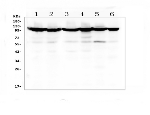 MSH2 Antibody - Western blot analysis of MSH2 using anti-MSH2 antibody. Electrophoresis was performed on a 5-20% SDS-PAGE gel at 70V (Stacking gel) / 90V (Resolving gel) for 2-3 hours. The sample well of each lane was loaded with 50ug of sample under reducing conditions. Lane 1: human HEK293 whole cell lysates, Lane 2: human HEK293 whole cell lysates, Lane 3: human Hela whole cell lysates, Lane 4: human COLO-320 whole cell lysates, Lane 5: human T-47D whole cell lysates, Lane 6: human A549 whole cell lysates. After Electrophoresis, proteins were transferred to a Nitrocellulose membrane at 150mA for 50-90 minutes. Blocked the membrane with 5% Non-fat Milk/ TBS for 1.5 hour at RT. The membrane was incubated with rabbit anti-MSH2 antigen affinity purified polyclonal antibody at 0.5 µg/mL overnight at 4°C, then washed with TBS-0.1% Tween 3 times with 5 minutes each and probed with a goat anti-rabbit IgG-HRP secondary antibody at a dilution of 1:10000 for 1.5 hour at RT. The signal is developed using an Enhanced Chemiluminescent detection (ECL) kit with Tanon 5200 system. A specific band was detected for MSH2 at approximately 105KD. The expected band size for MSH2 is at 105KD.