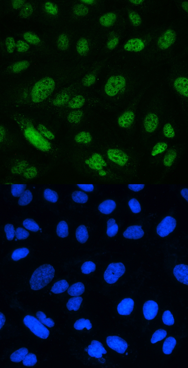 MSH2 Antibody - IF analysis of MSH2 using anti-MSH2 antibody MSH2 was detected in immunocytochemical section of U20S cell. Enzyme antigen retrieval was performed using IHC enzyme antigen retrieval reagent for 15 mins. The tissue section was blocked with 10% goat serum. The tissue section was then incubated with 2µg/mL rabbit anti-MSH2 Antibody overnight at 4°C. DyLight®488 Conjugated Goat Anti-Rabbit IgG was used as secondary antibody at 1:100 dilution and incubated for 30 minutes at 37°C. The section was counterstained with DAPI. Visualize using a fluorescence microscope and filter sets appropriate for the label used.