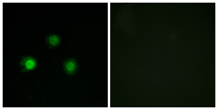 MSH2 Antibody - Immunofluorescence analysis of HUVEC cells, using MSH2 Antibody. The picture on the right is blocked with the synthesized peptide.