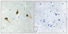 MSH2 Antibody - Immunohistochemistry analysis of paraffin-embedded human brain tissue, using MSH2 Antibody. The picture on the right is blocked with the synthesized peptide.