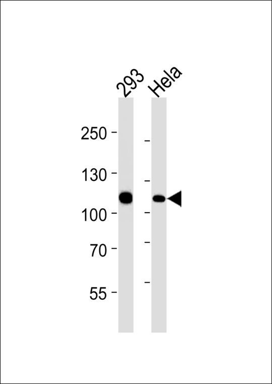 MSH2 Antibody - MSH2 Antibody western blot of 293, HeLa cell line lysates (35 ug/lane). The MSH2 antibody detected the MSH2 protein (arrow).