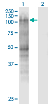 MSH2 Antibody - Western Blot analysis of MSH2 expression in transfected 293T cell line by MSH2 monoclonal antibody (M01), clone 2G9.Lane 1: MSH2 transfected lysate (Predicted MW: 104.7 KDa).Lane 2: Non-transfected lysate.