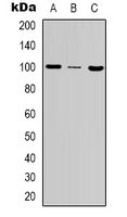 MSH2 Antibody - Western blot analysis of MSH2 expression in HeLa (A); A431 (B); NIH3T3 (C) whole cell lysates.