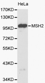 MSH2 Antibody - Western blot of MSH2 pAb in extracts from Hela cells.