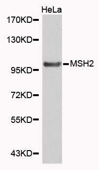 MSH2 Antibody - Western blot analysis of extracts of HeLa cells.