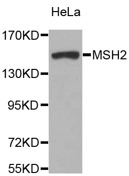 MSH2 Antibody - Western blot analysis of extracts of HeLa cells, using MSH2 antibody. The secondary antibody used was an HRP Goat Anti-Rabbit IgG (H+L) at 1:10000 dilution. Lysates were loaded 25ug per lane and 3% nonfat dry milk in TBST was used for blocking.